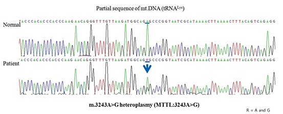DNA 검사. 미토콘드리아 유전자 분석 과정. 
