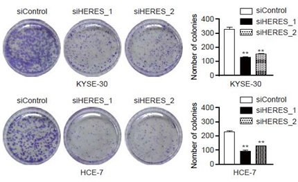 KYSE-30, HCE-7 두 암세포 군락에 HERES를 억제한 결과 암세포 군락이 현저히 줄어 HERES가 암세포 증식에 관여한다는 사실을 확인했다.