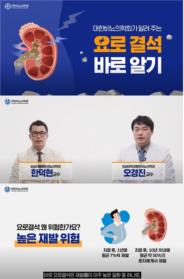 대한비뇨의학회 '요로결석 바로알기'(대한비뇨의학회 제공).