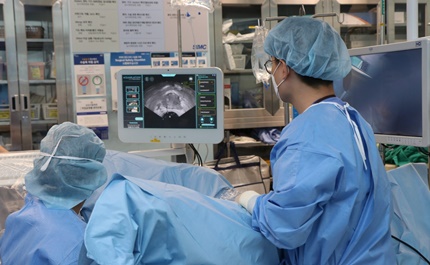 삼성서울병원 비뇨의학과 이규성 교수가 로봇수술 장비 ‘아쿠아블레이션’을 사용해 전립선비대증 수술을 하고 있다.