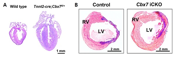 A: 마우스모델의 심장(왼쪽)에서 Cbx7 유전자 활성을 조절해 심근세포를 억제했을 때 심장의 크기가 증가하고 심근의 두께가 증가했다(오른쪽). B: 심장마비 마우스모델(왼쪽)에서 Cbx7 유전자를 제거한 결과, 심장 섬유화가 감소하고 심근이 증가했다(오른쪽).